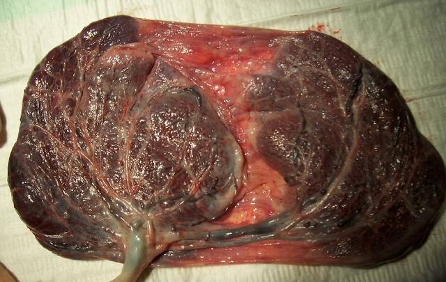 紫河车,古老药材的价格变迁