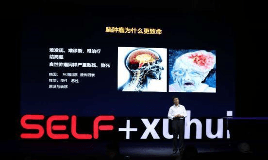 最新近视治疗进展,科技之光重塑视界