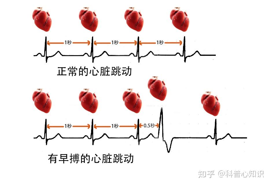 最新早搏吧,带你领略心跳的节奏!