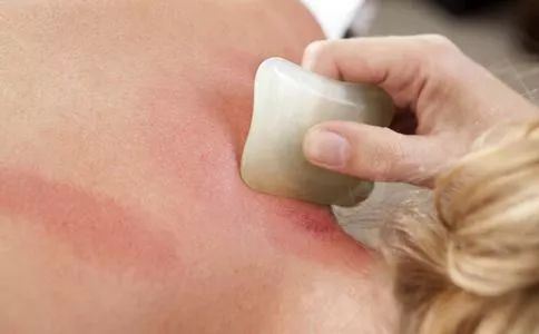 最新滴痧操作指南,一步步教你完成这项任务